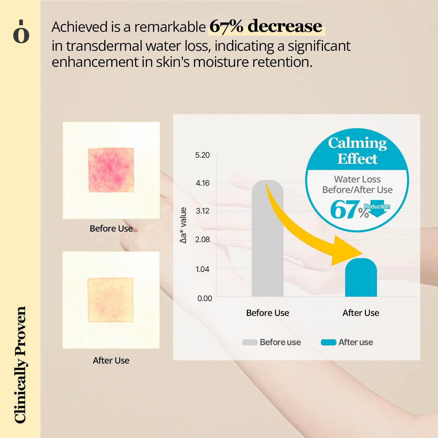 Centella Asiatica Skin Barrier Calming Lotion, Instantly Soothes Sensitive Skin, Moisturizing Lotion for Dry Skin, Vegan, Korean Skin Care, 7.43 Fl Oz